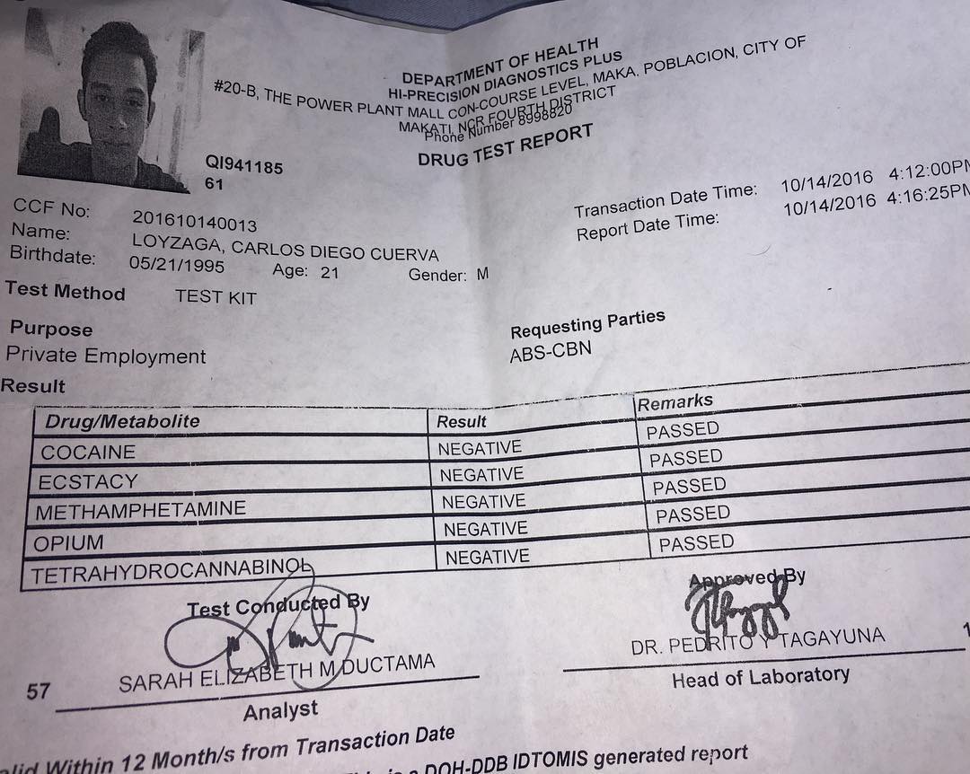 Diego Loyzaga shows result of drug test