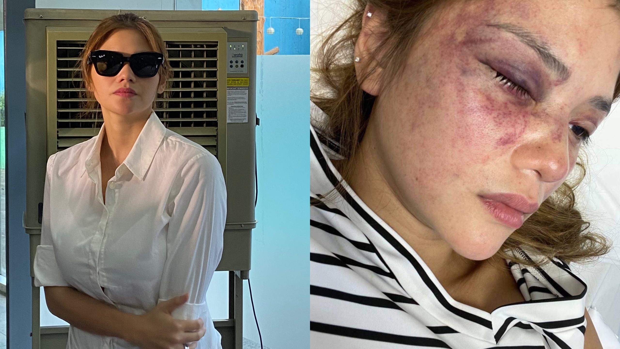 Ana Jalandoni airs her side; lawyer Faye Singson joins the fight to end violence against women